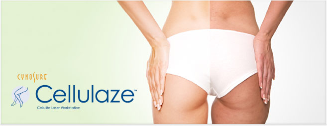 cellulaze